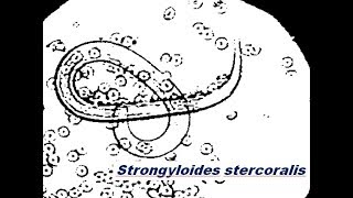 Strongyloides stercoralis [upl. by Eiramanitsirhc181]