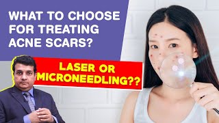 Best Solution for Acne Scars Laser Treatment vs Microneedling RF Dermalife [upl. by Imekawulo]