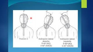 Video GONIOMETRIA DE COLUMNA [upl. by Conlen]