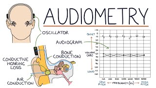 Understanding Audiometry and Audiograms [upl. by Tnafni15]