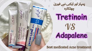 Best Acne Fighting Products  Medicated Acne Treatment  Dermatologist Recommended Creams [upl. by Eibrab]