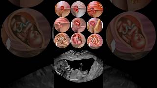 Fetal Development Month by Month😍 [upl. by Anerak567]