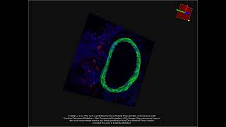 hNSCs treatment for neonatal hypoxicischemic brain injury  Supplementary video ID 350586 [upl. by Ahsiekrats]