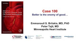 Case 100 Manual of CTO Interventions Better is the enemy of good [upl. by Eusassilem533]