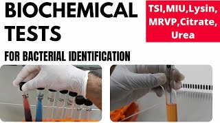 Biochemical Tests for Bacterial Identification Part1TSI MIU MRVP Lysin Urea Citrate [upl. by Comfort113]