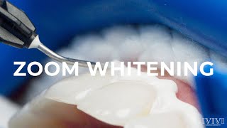 416 Dentistry  ZOOM WHITENING Step by Step Procedure and Before amp After [upl. by Chantalle468]