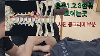 경장근 촉진longus colli palpation 및 도수운동manipulation motion 뒷목이 뻐근할때ㅡ》 경장근이 이완이 안되서 경추 신전근이 뭉친경우 [upl. by Essie]