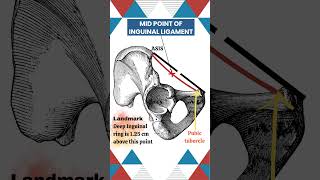 Understanding MidInguinal Point Key Anatomy Explained Anatomy MedicalEducation InguinalRegion [upl. by Yendic]