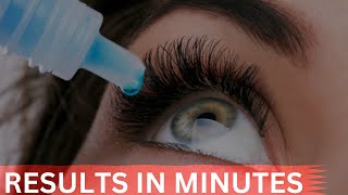 How to get rid of Under Eye Bags Result in minutes and Fade Dark circle [upl. by Penman]