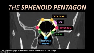 A Jingle for Foramen Rotundum Vidian and SOF CT [upl. by Einreb]