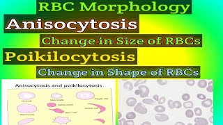 RBC MORPHOLOGY What is Anisocytosis What is Poikilocytosis [upl. by Choong]