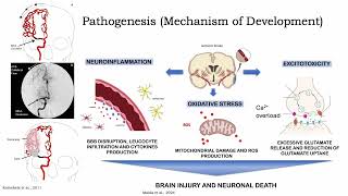 Acute Ischemic Stroke Pathophysiology [upl. by Meagher545]