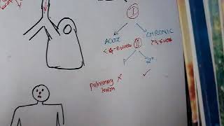 Lung abscess part 2  respiratory system [upl. by Norha281]