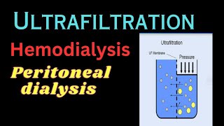 Ultrafiltration in Dialysis  what is UFR ultrafiltration rate principle of dialysis part2 [upl. by Aiuqet512]