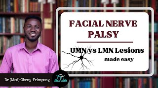 UMN lesions vs LMN lesions of the Facial Nerve  Made Simple  TutorMed [upl. by Larok]