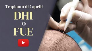 Trapianto di capelli FUE o DHI Qual è la scelta migliore nel 2023 [upl. by Nutsud]