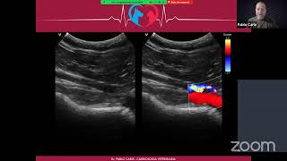 Webinar Ecocardiografia Doppler Veterinaria [upl. by Hairakcaz]