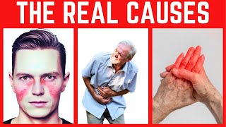 The 7 REAL Causes of ALL Disease [upl. by Mick]