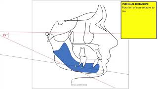 mandibular rotation [upl. by Angelika]