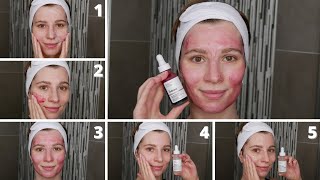 How to Apply The Ordinary 30 AHA  2 BHA Peeling Solution with Niacinamide and Alpha Arbutin [upl. by Asus352]