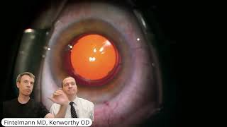 Implantation of light adjustable lens [upl. by Jackson670]