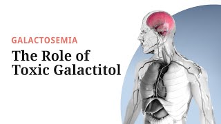 Galactosemia Pathogenesis The Role of Toxic Galactitol [upl. by Nilra]