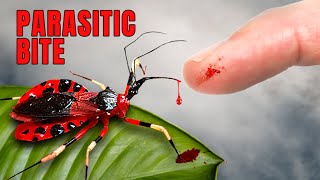 ASSASSIN BUG puts me in the Hospital [upl. by Atteve]