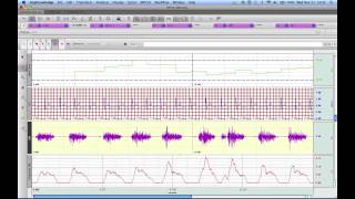 AcqKnowledge Grid Functionality Tutorial [upl. by Naihtsirc674]