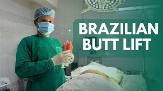 Brazilian Butt Lift  BBL  Buttock Enlargement  Butt Lift  Fat Transfer  Body Shaping [upl. by Leinehtan294]