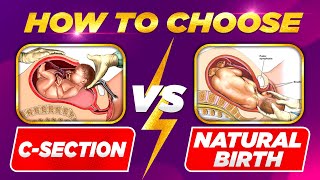 Natural Birth vs CSection The Choice is Yours… or Not 🤔🤱 Pregnancy Delivery MUST WATCH Video🤰 [upl. by Zevahc]