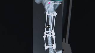 Biomaterials part 1 materialsscience biomaterials materialsengineering [upl. by Jasmin]