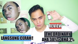 THE ORDINARY AHA 30 BHA 2 PEELING SOLUTION REVIEW  MASKER TERBAIK BUAT KOMEDO amp JERAWAT [upl. by Jovitta910]