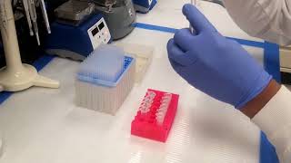 DNA Purification of PCR Product [upl. by Sicular719]