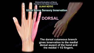 ULNAR NERVE INJURY CAUSES SYMPTOMS DIAGNOSIS AND TREATMENT Cubital tunnel syndrome [upl. by Aicilegna405]