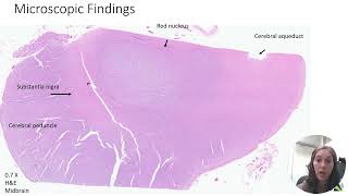 Neuropathology  Part 1 [upl. by Acinaj]