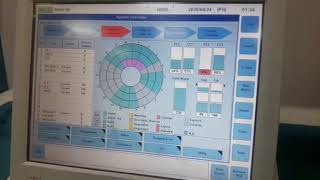 Roche Hitachi e411 Routine Maintenance [upl. by Weil]