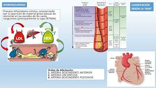 ❤❤Resumen completo de CARDIOPATIA ISQUÉMICA  ANGINA  INFARTO AGUDO MIOCARDIO IAM [upl. by Yhtac]