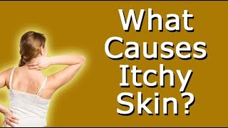 What Causes Itchy Skin [upl. by Sigismundo]