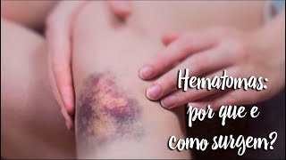 Hematomas por que e como surgem  by Farmácias Pague Menos [upl. by Leviram616]