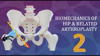 Hip Joint Biomechanics and arthroplasty Simplified Basics Part 2 of 3 [upl. by Anilak]