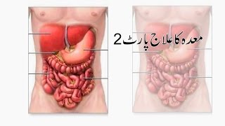 maida ka ilaj part2 by Hakeem Amir Razaq Obhaya [upl. by Ferino]