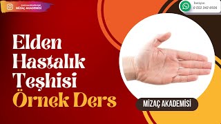 Elden Hastalık Teşhisi Ücretsiz Ders [upl. by Kassey540]