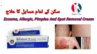 Betaderm N cream benefits uses side effects Urdu and Hindi [upl. by Bouchier]