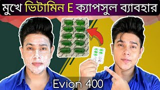 Evion 400 এর সাহায্যে মুখ ফর্সা এবং ব্রণ কমানোর 100  কার্যকরী সহজ উপায়  ভিটামিন ই ক্যাপসুল [upl. by Alraep]