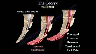 Coccydynia  coccyx pain coccyx pain causes diagnosis and treatment [upl. by Ynafetse]