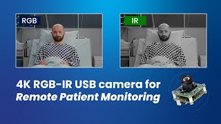 4K RGBIR USB camera for Remote Patient Monitoring  Simultaneous RGB amp IR Streaming  econ Systems [upl. by Dilisio]