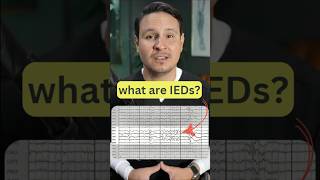 Interictal Epileptiform Discharges on EEG eeg neuroscience epilepsy neurology seizures [upl. by Jane40]