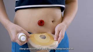 Caracara Menanggalkan dan Memasang Beg Stoma 1 piece Sistem Coloplast Alterna® [upl. by Drawde]