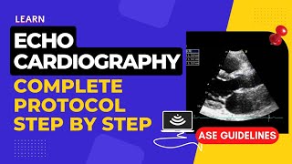 Echocardiography Standard Protocol  Step by Step  Complete Transthoracic Normal Echocardiogram [upl. by Anoblav]