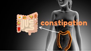 7 Facts you don’t know about constipation I Health and Nutrition [upl. by Lombardi208]